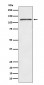 FYB Antibody